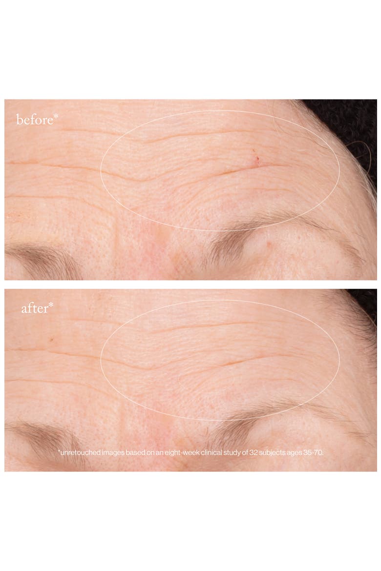 3X Retinol Regenerative Serum, Alternate, color, NO COLOR