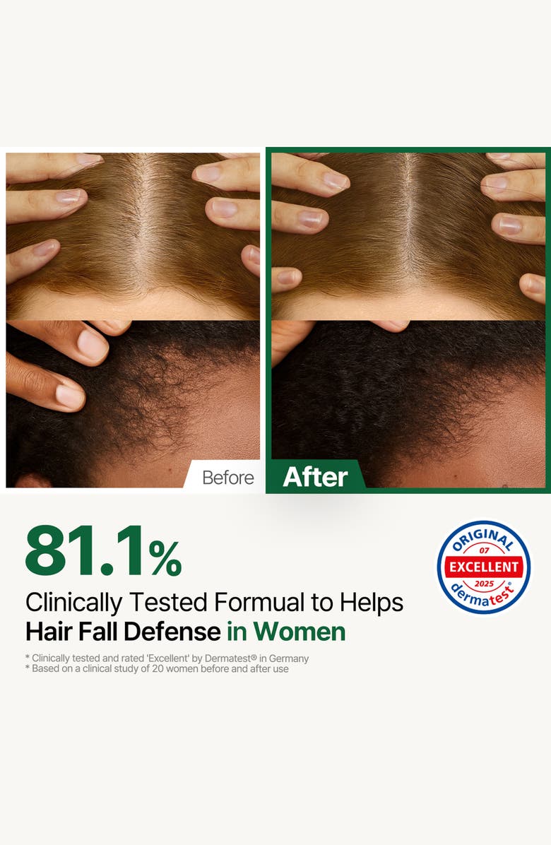 ROOTON Alpha Erguen Scalp & Hair Treatment, Alternate, color,
