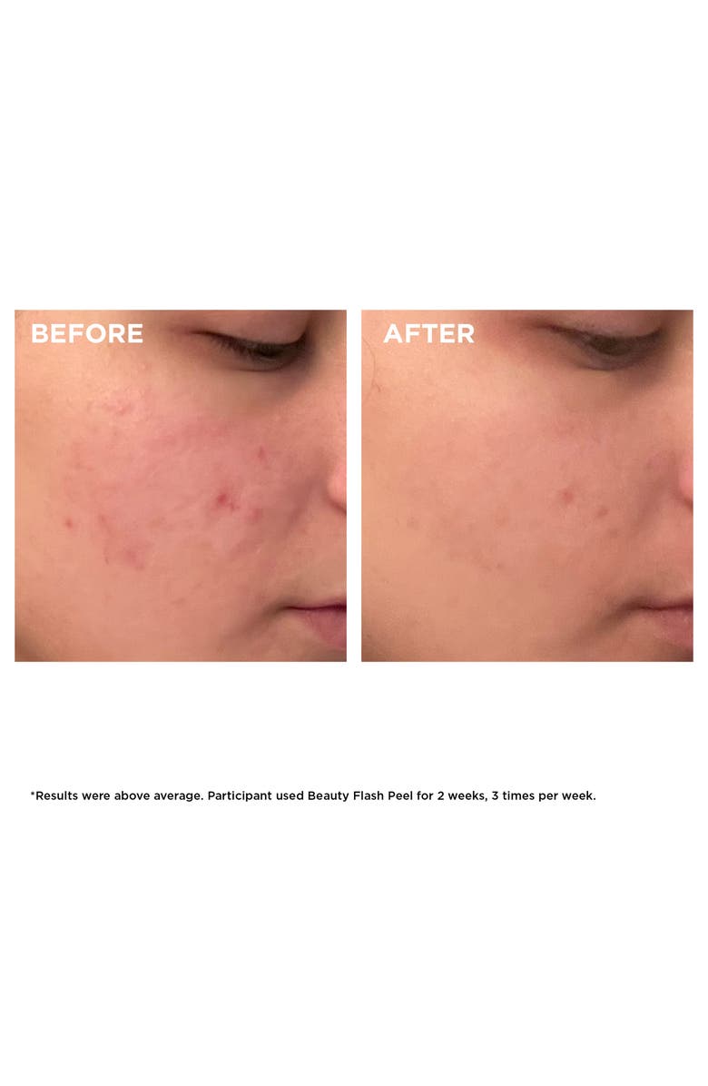 Clarins Beauty Flash Peel with BHA & AHA, Alternate, color,