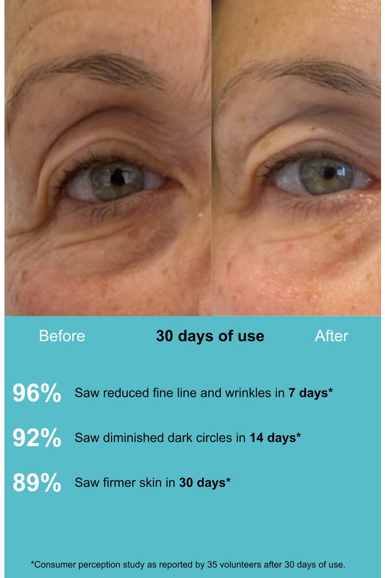 Ultimate Renewal Eye Cream, Alternate, color, BLUE