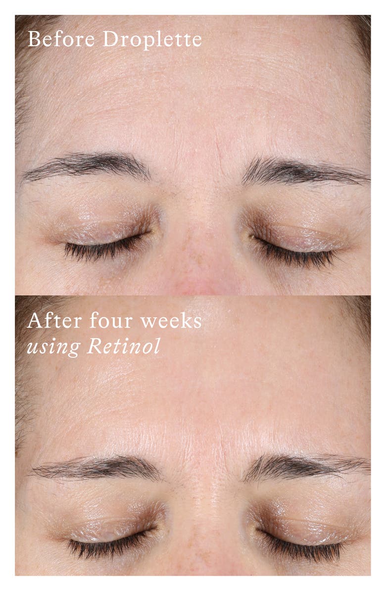 Droplette Microinfusion Device, Alternate, color, 