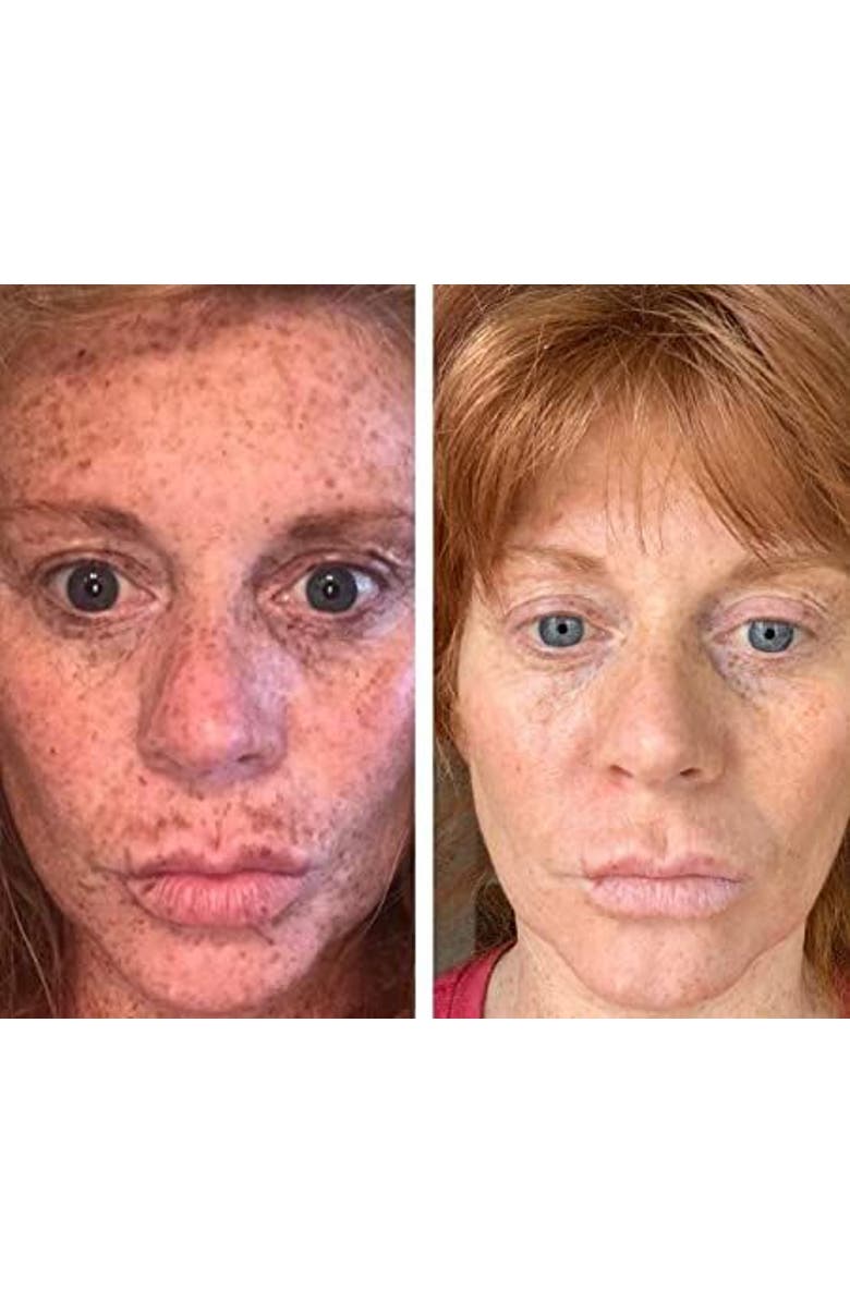 Admire My Skin Ultra Potent Brightening Serum Dark Spot Corrector, Alternate, color, Clear