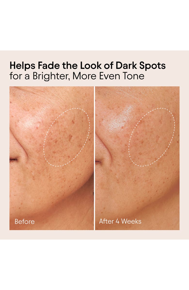 Alpyn Instant Glow Serum with Vitamin C & Bearberry, Alternate, color, 