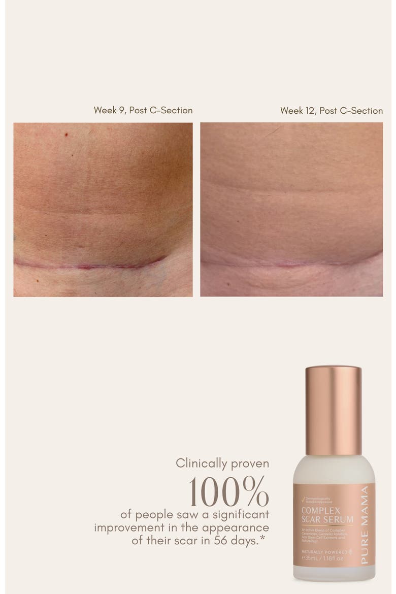 Complex Scar Serum, Alternate, color, White