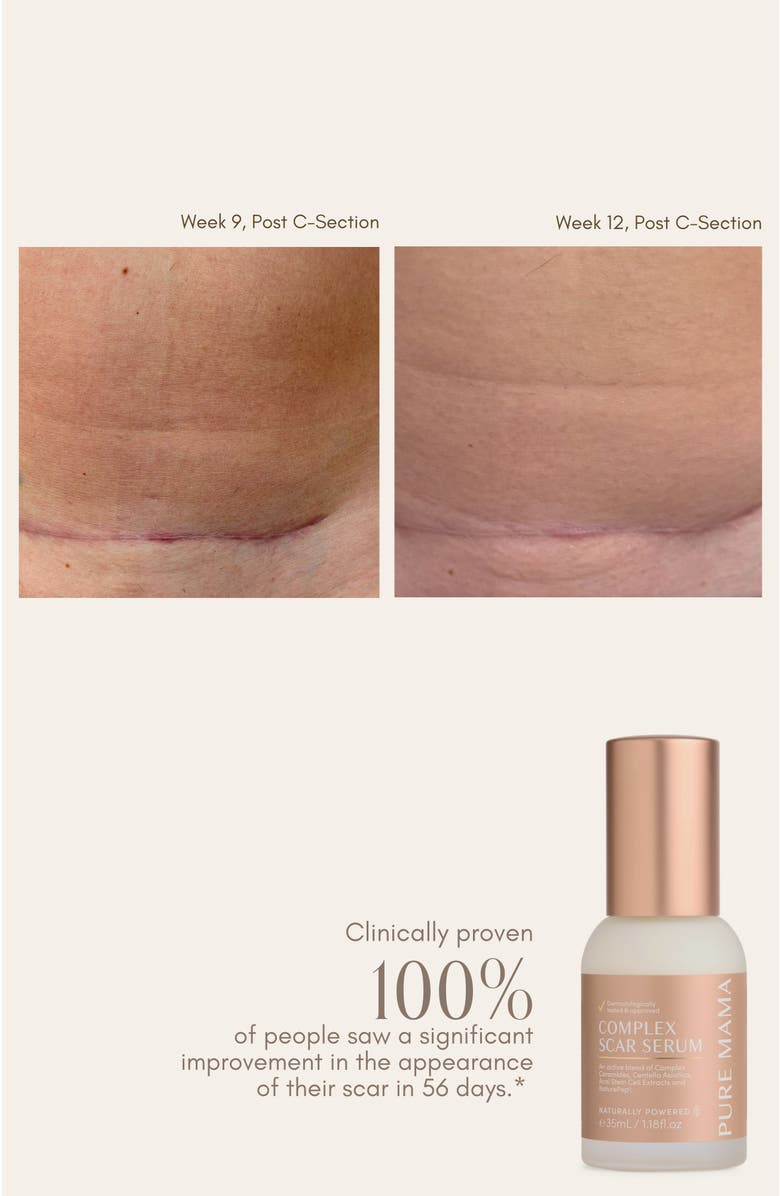 PURE MAMA Complex Scar Serum, Alternate, color, White