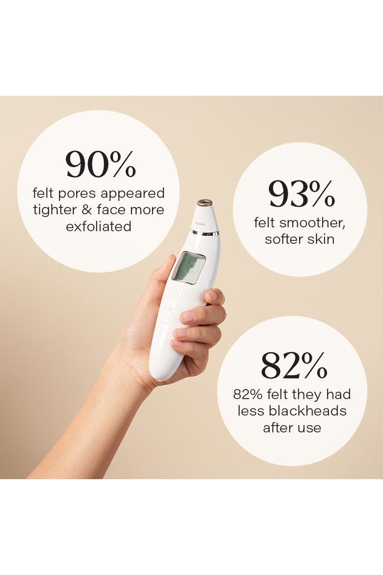 Exfora Personal Microdermabrasion Wand, Alternate, color, White