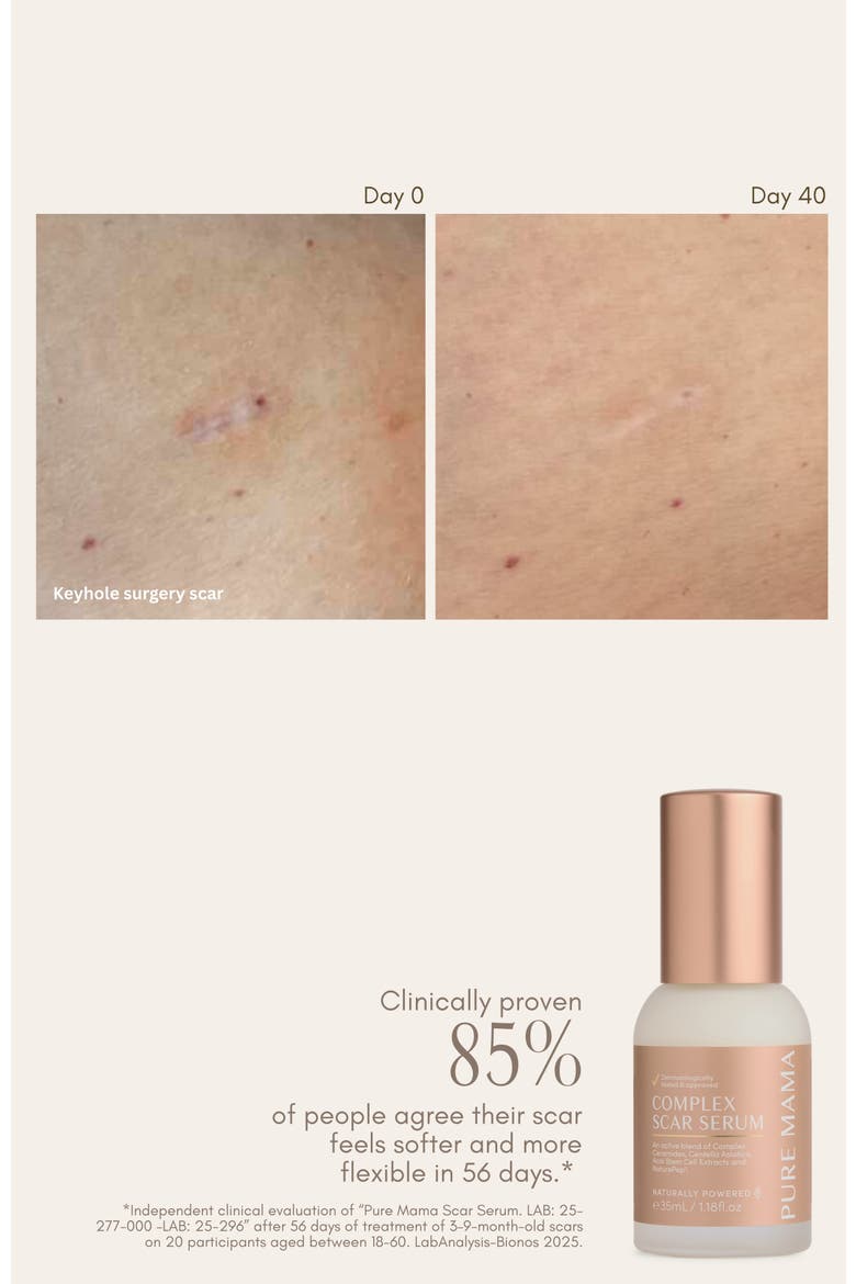 Complex Scar Serum, Alternate, color, White