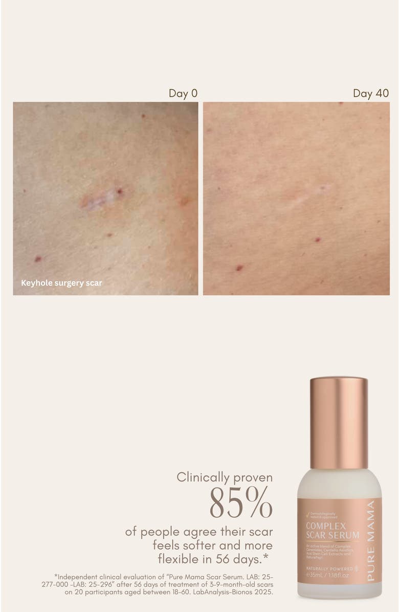 PURE MAMA Complex Scar Serum, Alternate, color, White
