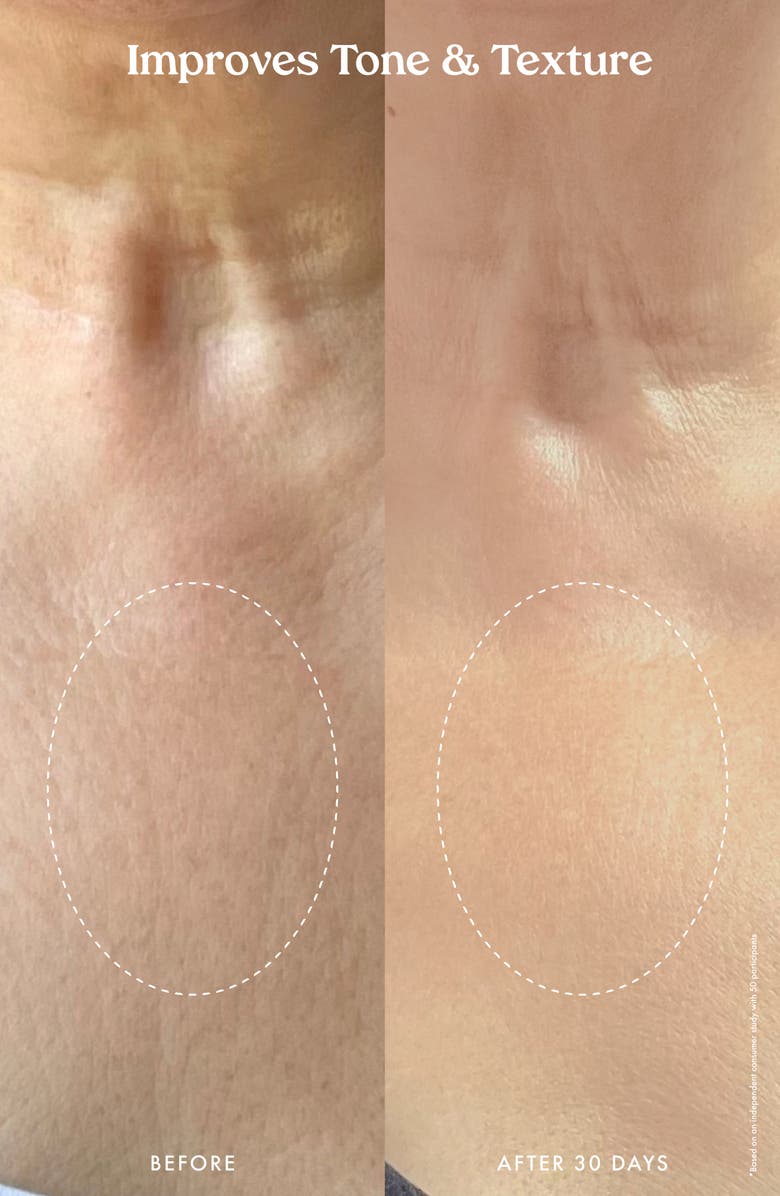 Kopari Ultra Restore Firming Body Serum, Alternate, color, 