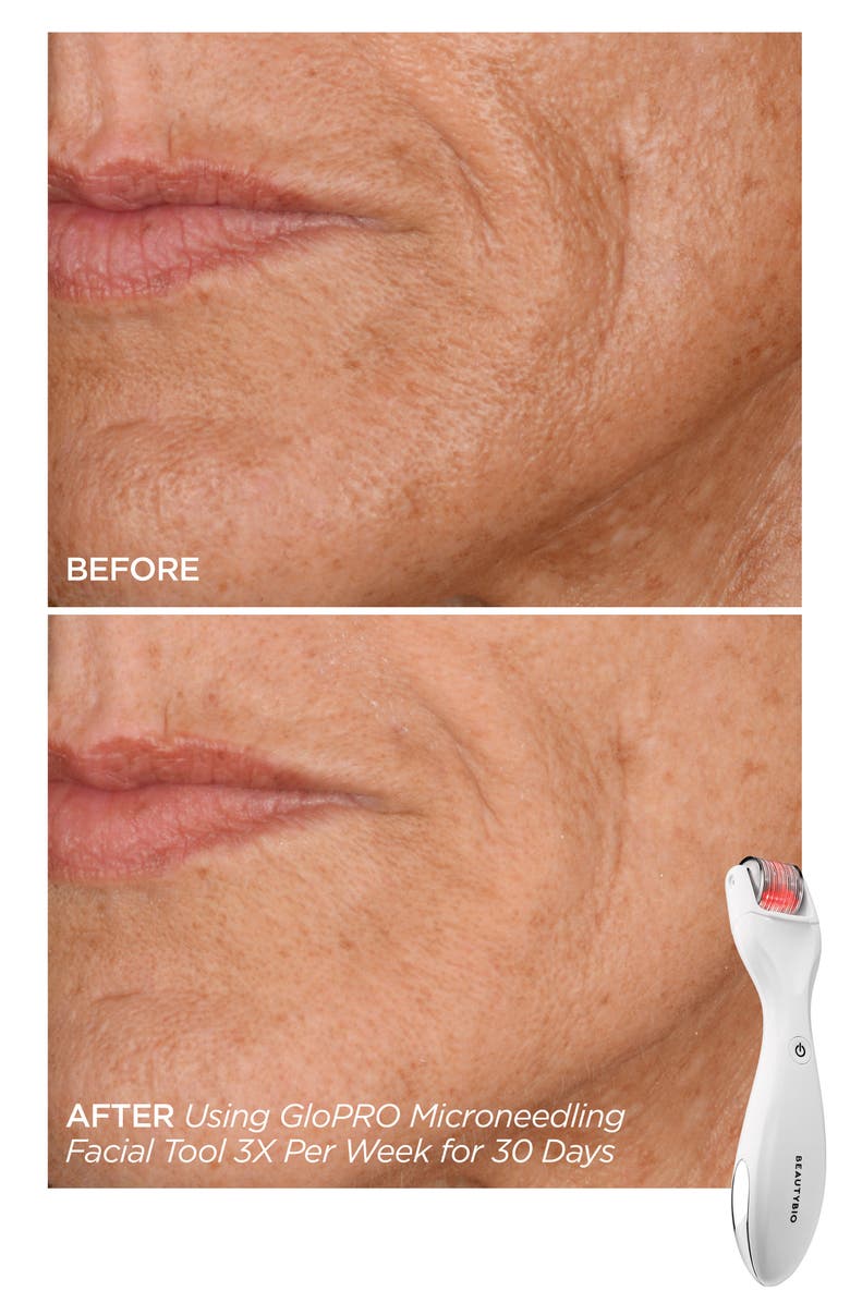 BeautyBio GloPRO Skin Care Set-$354 Value, Alternate, color,