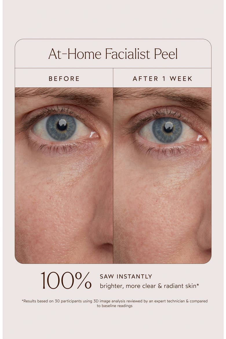 At-Home Facialist Peel, Alternate, color, NO COLOR