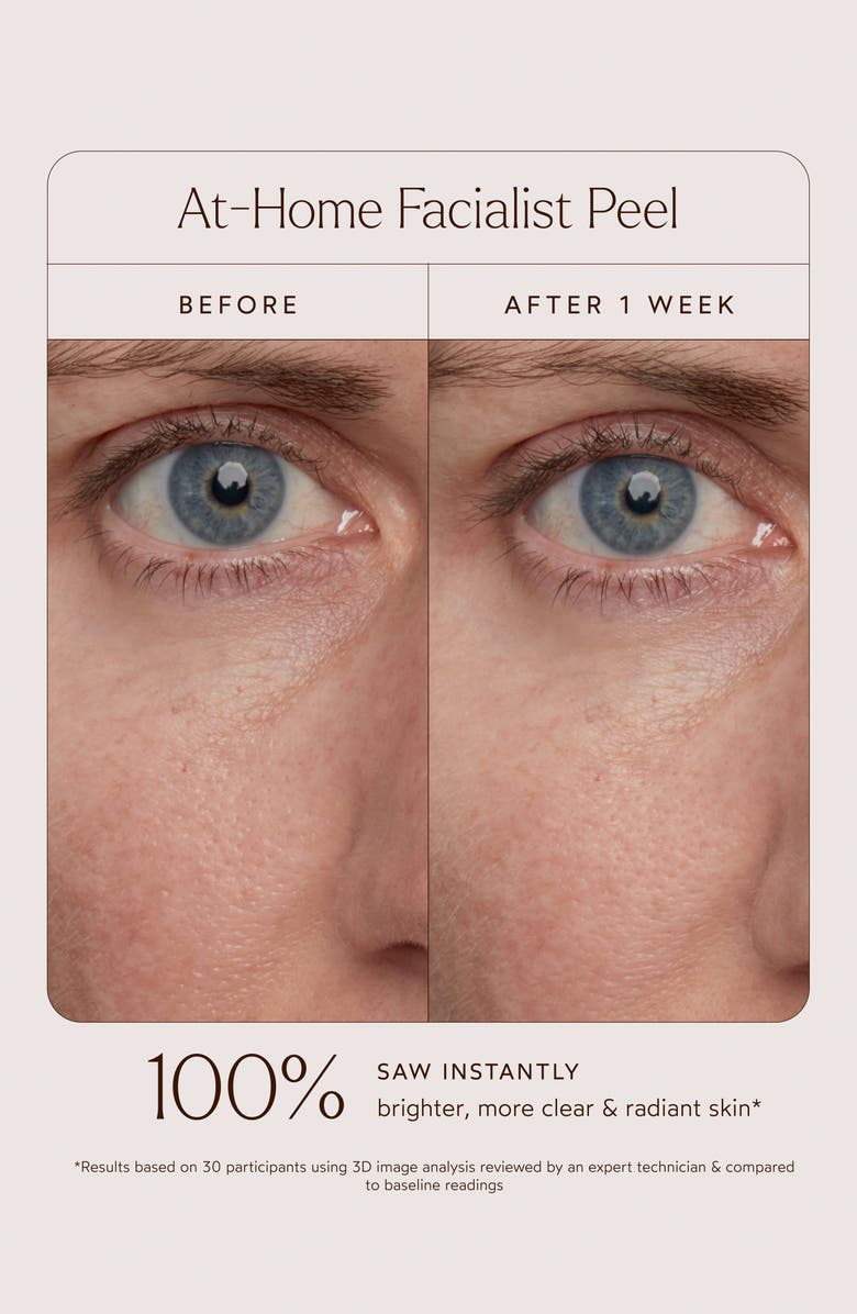 True Botanicals At-Home Facialist Peel, Alternate, color, 