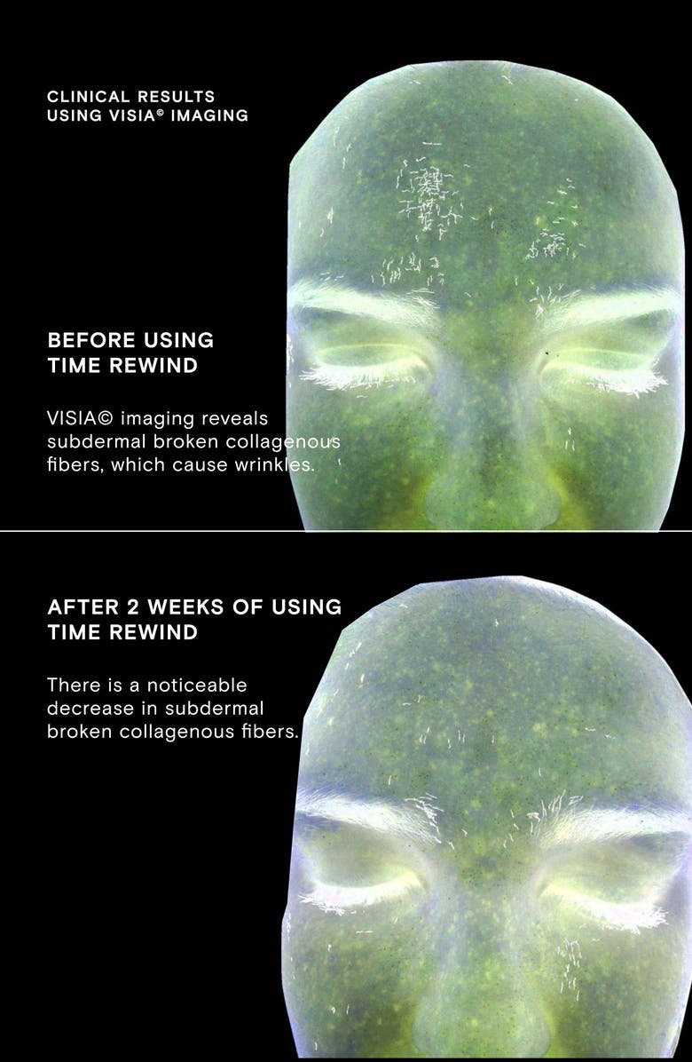 Exponent Beauty Time Rewind Retinol + Hyaluronic Acid Power Serum, Alternate, color, 