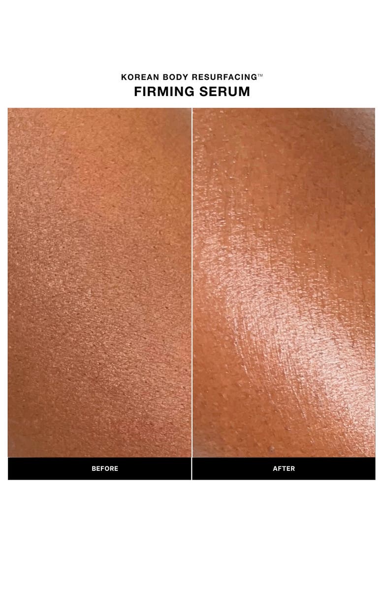 LILIS Korean Body Resurfacing Firming Serum, Alternate, color,