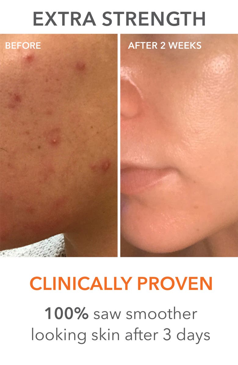 Dr. Dennis Gross Skincare The Glow Up Set $257 Value, Alternate, color,