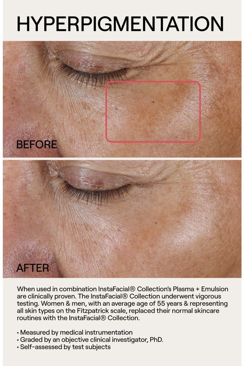 Instafacial® Plasma Serum Duo $400 Value, Alternate, color, NO COLOR
