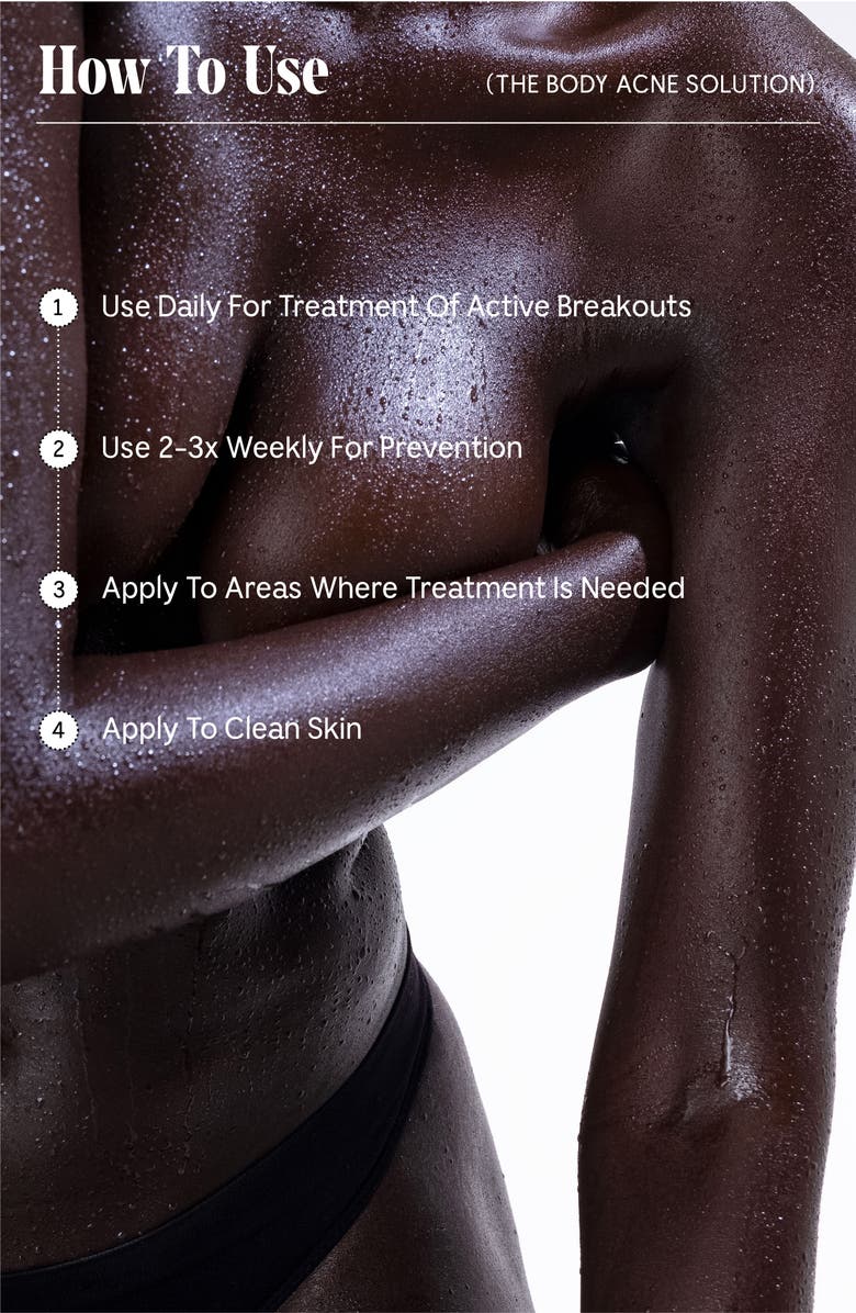 Nécessaire The Body Acne Solution, Alternate, color,