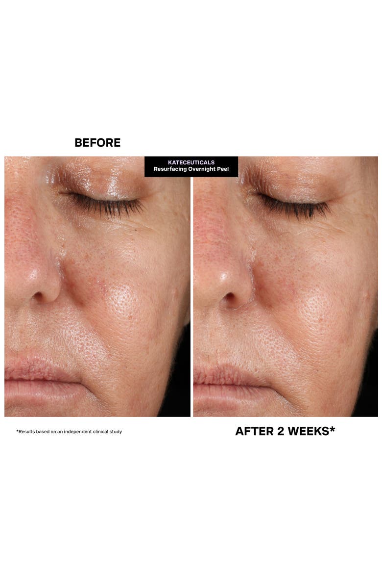 Kateceuticals® Resurfacing Overnight Peel (Nordstrom Exclusive), Alternate, color, NO COLOR