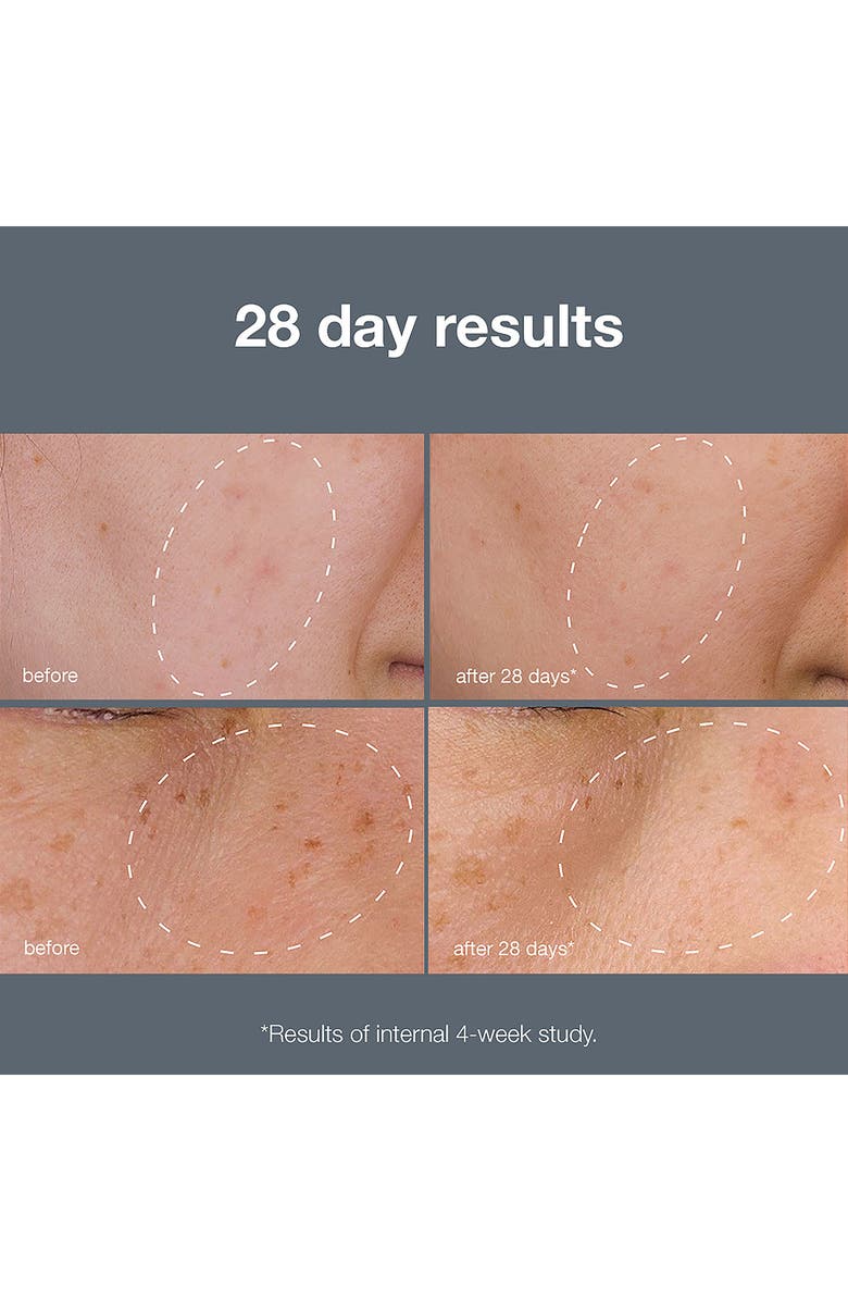 dermalogica<sup>®</sup> PowerBright Dark Spot System Set $178 Value, Alternate, color,