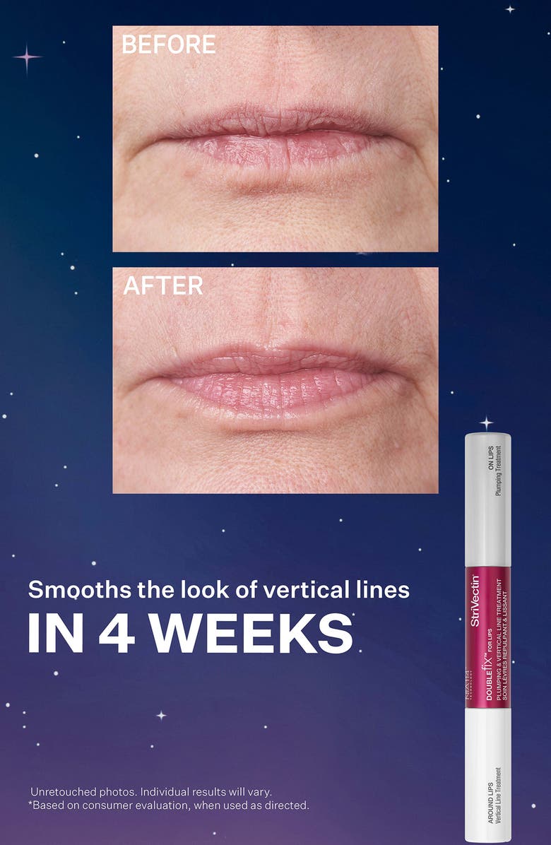 StriVectin<sup>®</sup> Smooth & Plump Holiday Skin Care Set (Limited Edition) $193 Value, Alternate, color, 