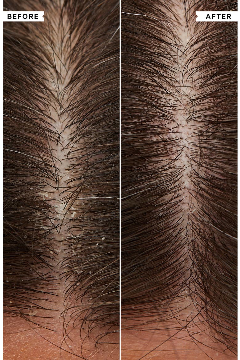 Flaky Scalp Calming Scalp Toner, Alternate, color, NO COLOR