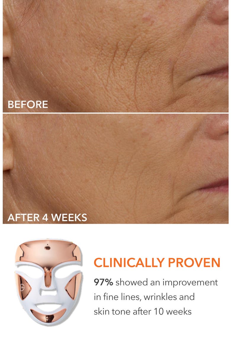 Collagen Boosting Essentials Set $641 Value, Alternate, color, NO COLOR