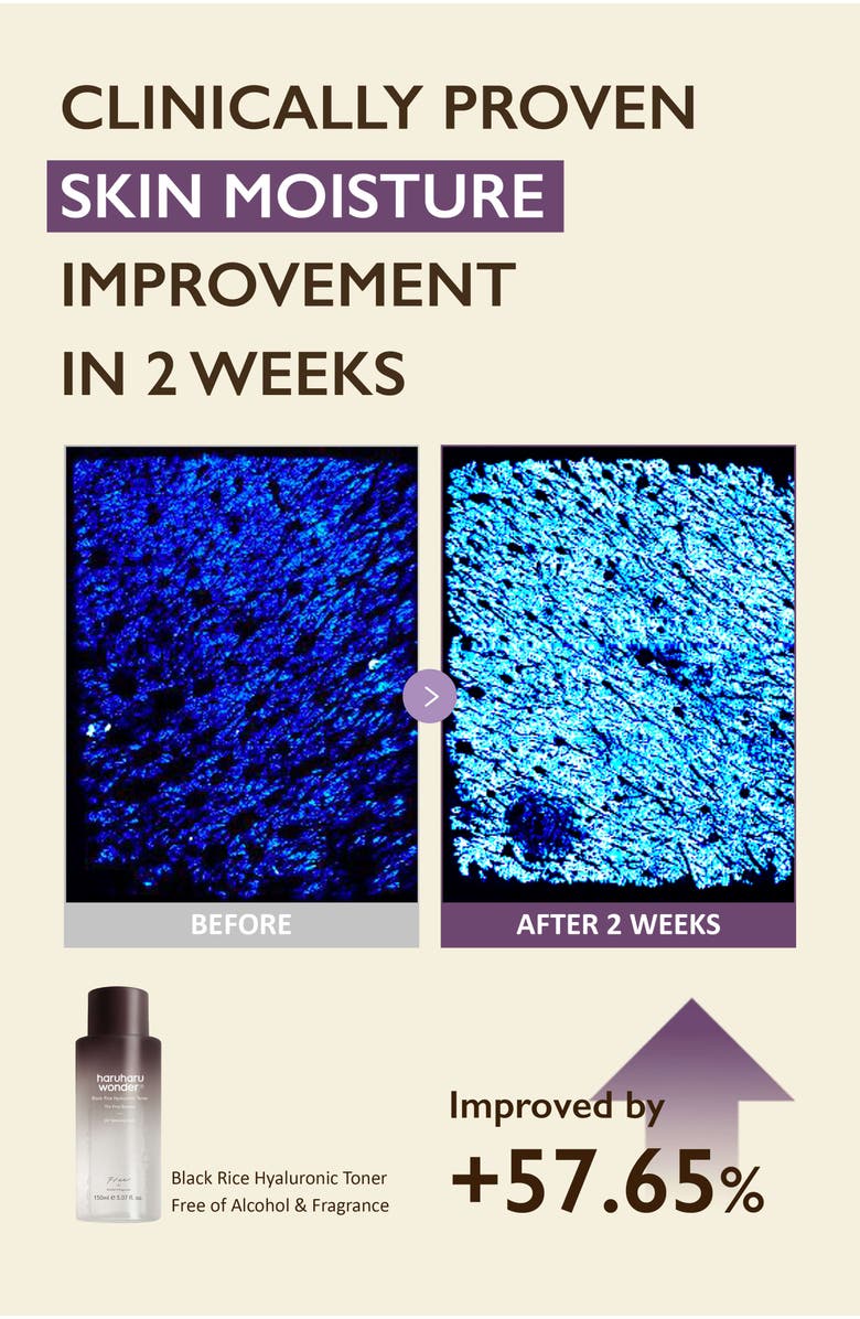 haruharu wonder Cleanse & Glow Set, Alternate, color, NO COLOR