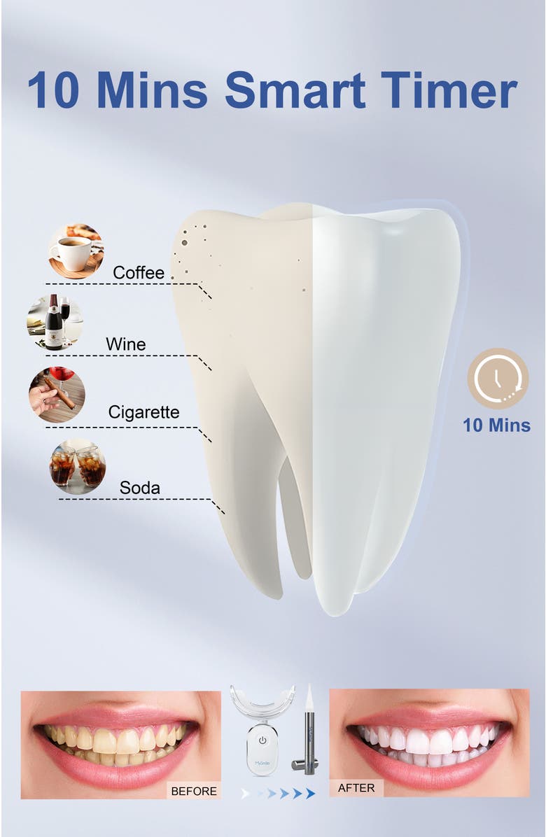 MySmile 35% CP Teeth Whitening Kit Enhanced Teeth Whitener, 4 Pc Teeth Whitening Pen, 24 Treatments, Alternate, color, Silver