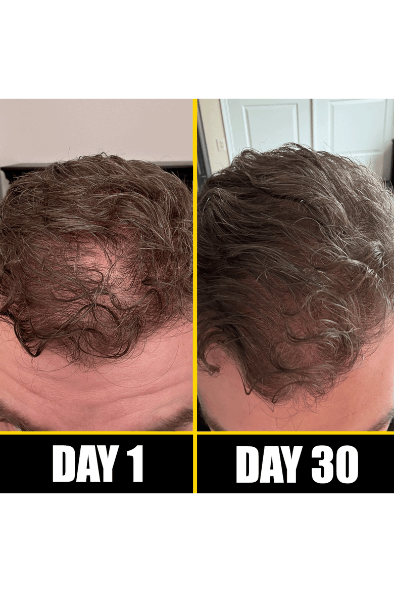 Boost Hair & Beard Growth Strengthening Serum With Biotin & Rosemary, Alternate, color, Brown
