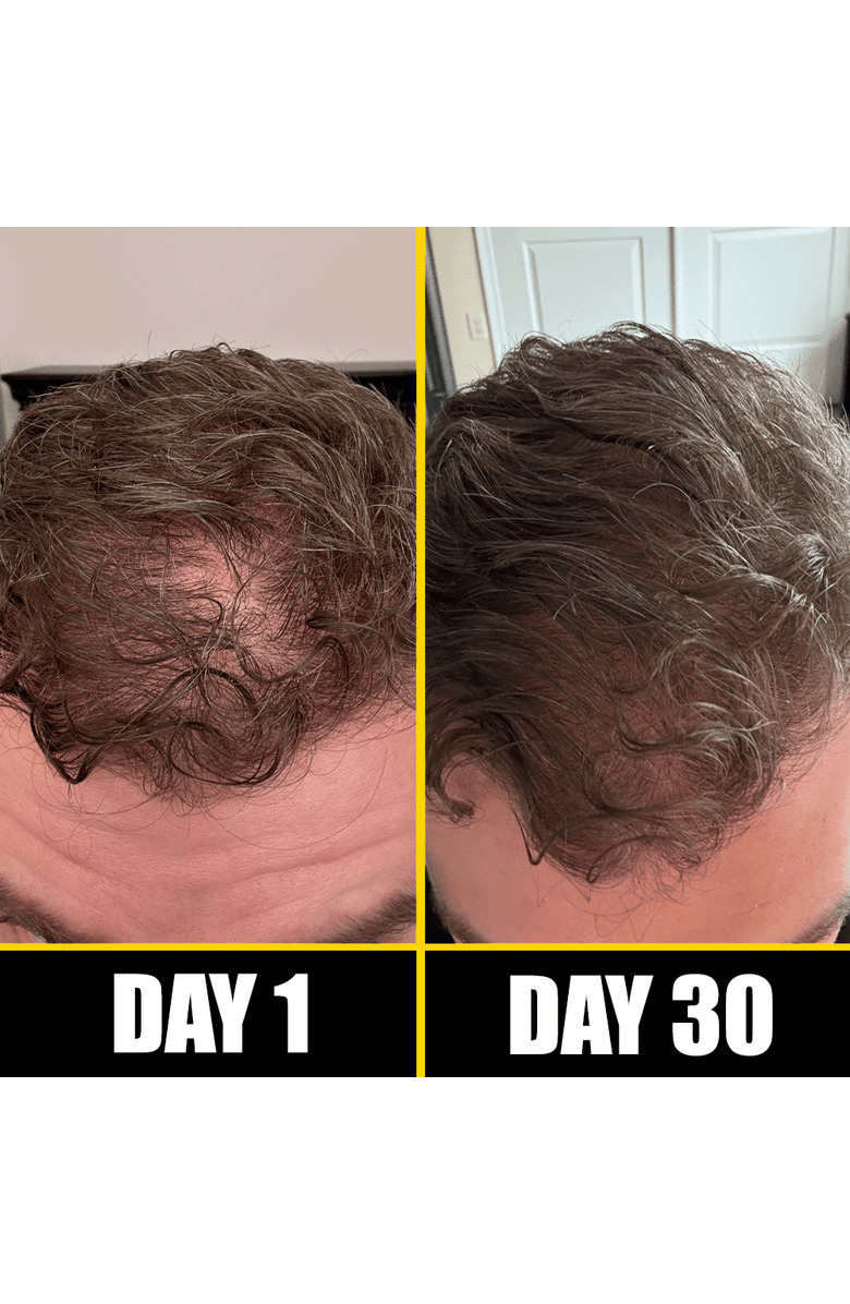 Pete & Pedro Boost Hair & Beard Growth Strengthening Serum With Biotin & Rosemary, Alternate, color, Brown