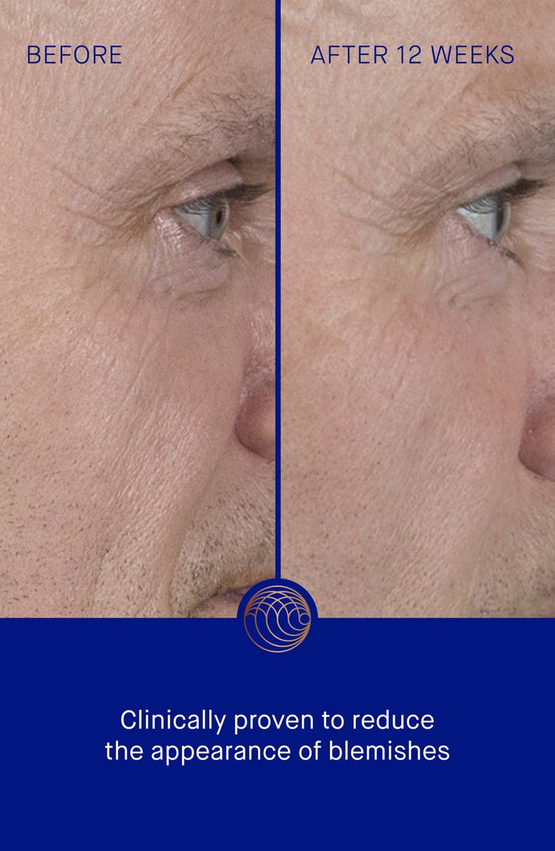 Augustinus Bader The Serum, Alternate, color, Regular