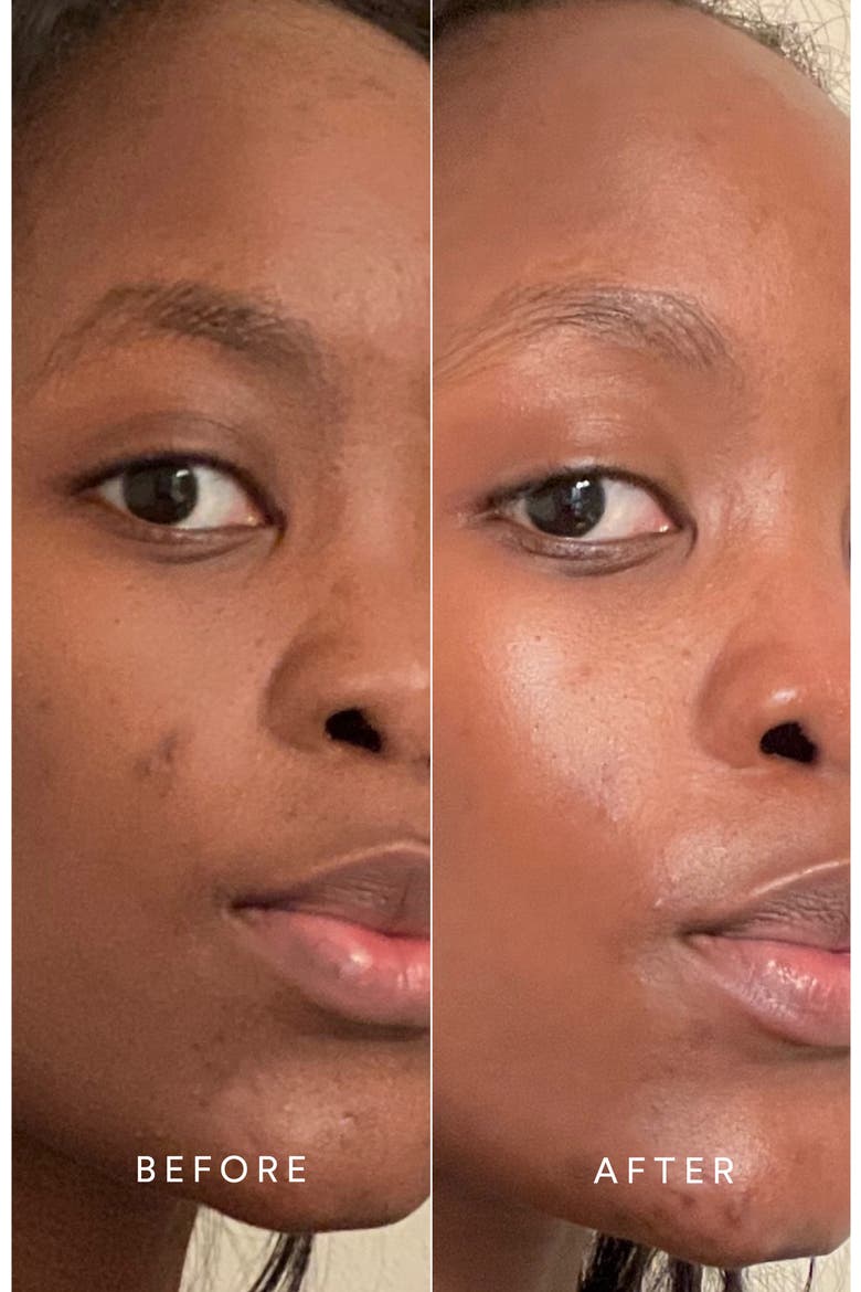 Fresh Dewy Skin Collection Set $222 Value, Alternate, color, NO COLOR