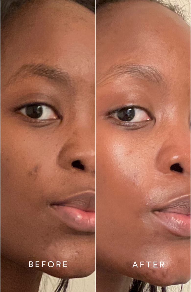 True Botanicals Fresh Dewy Skin Collection Set $222 Value, Alternate, color,