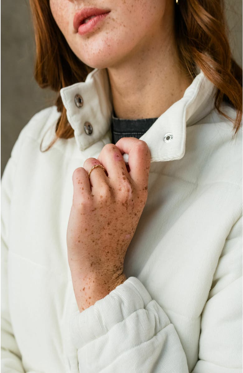 ABLE Charla Puffer Jacket, Alternate, color, 