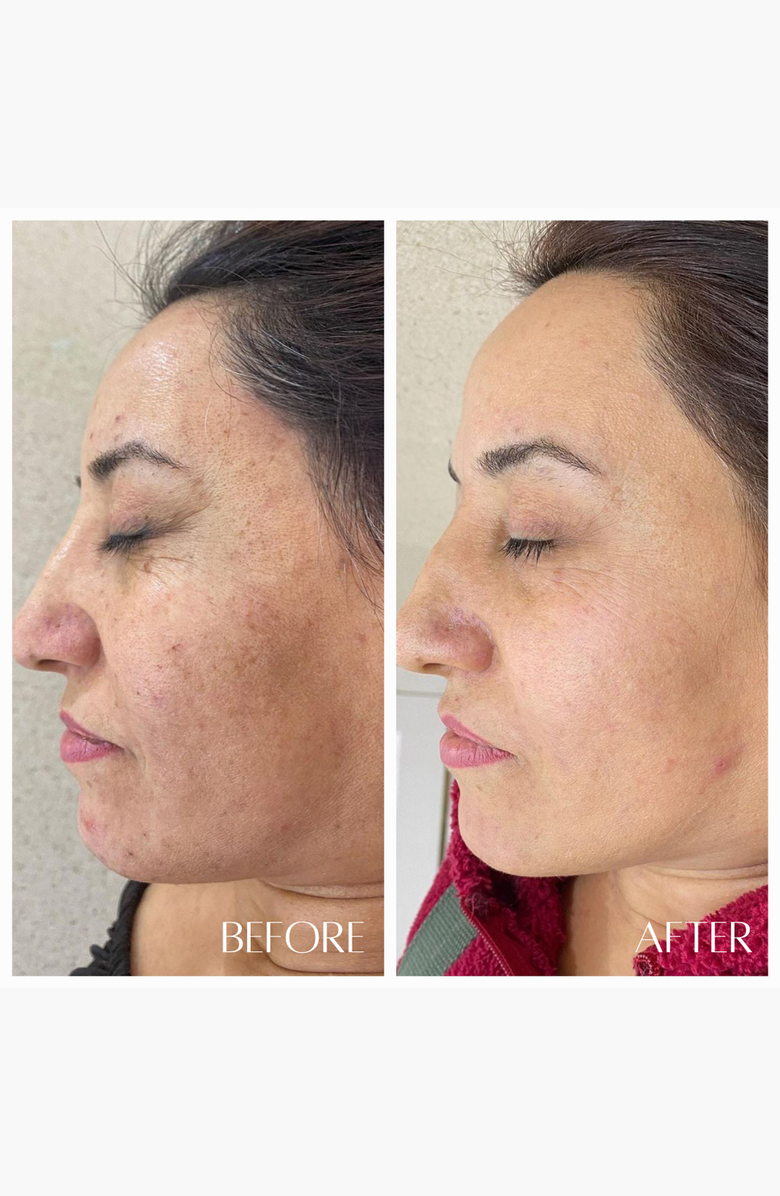 botanicary No. 3 RESURFACE AHA & Enzyme Brightening Nectar, Alternate, color, Amber / Gold