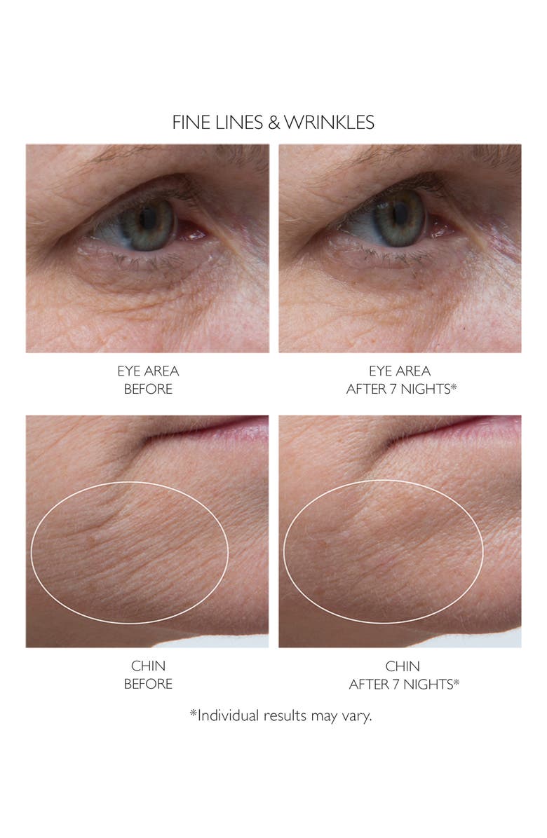 Peter Thomas Roth Retinol Fusion PM Serum, Alternate, color,