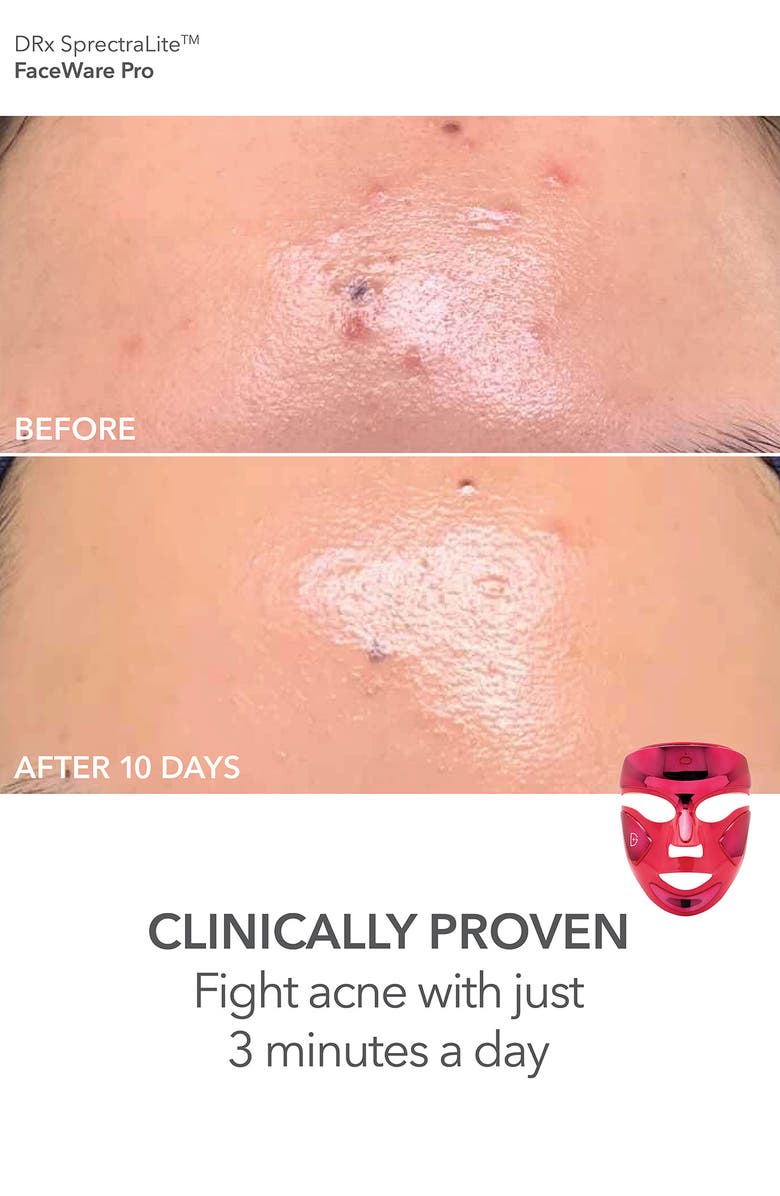 Dr. Dennis Gross Skincare Luminous Legends FaceWare Pro LED Device & Skin Care Essentials Set, Alternate, color, 