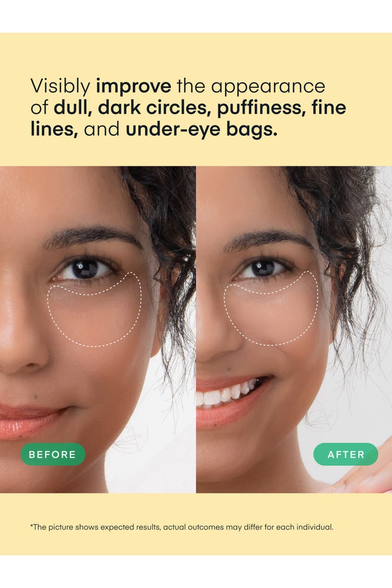 Vitamin C Eye Patches, Alternate, color, No Color
