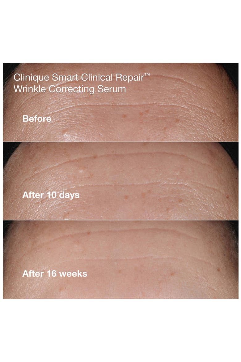 Wrinkle Fighting Routine Anti-Aging Skincare Gift Set $129 Value, Alternate, color, NO COLOR