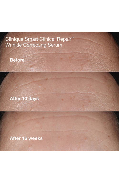 Clinique Wrinkle Fighting Routine Anti-aging Skincare Gift Set $129 Value In Transparent