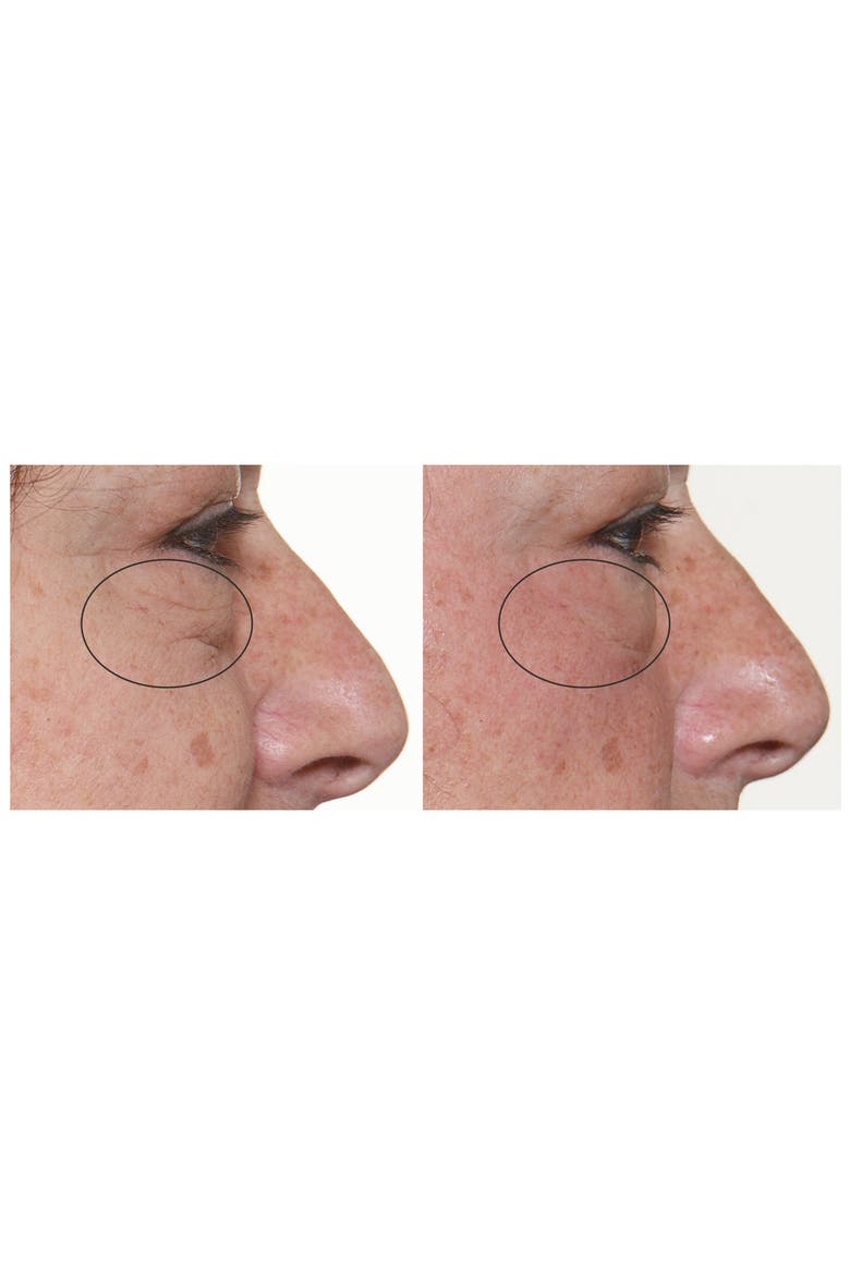 FaceFX™ Anti-Aging Device, Alternate, color, NO COLOR