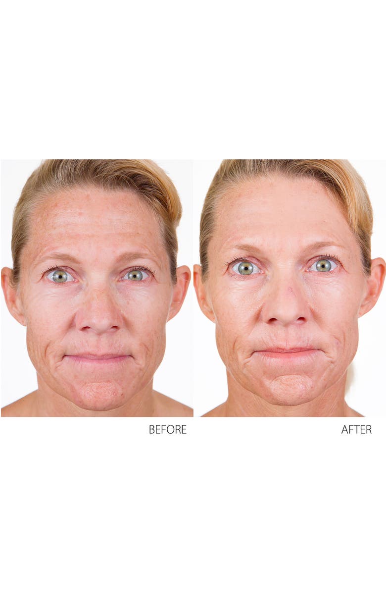 Conture Kinetic Skin Toning System, Alternate, color, 