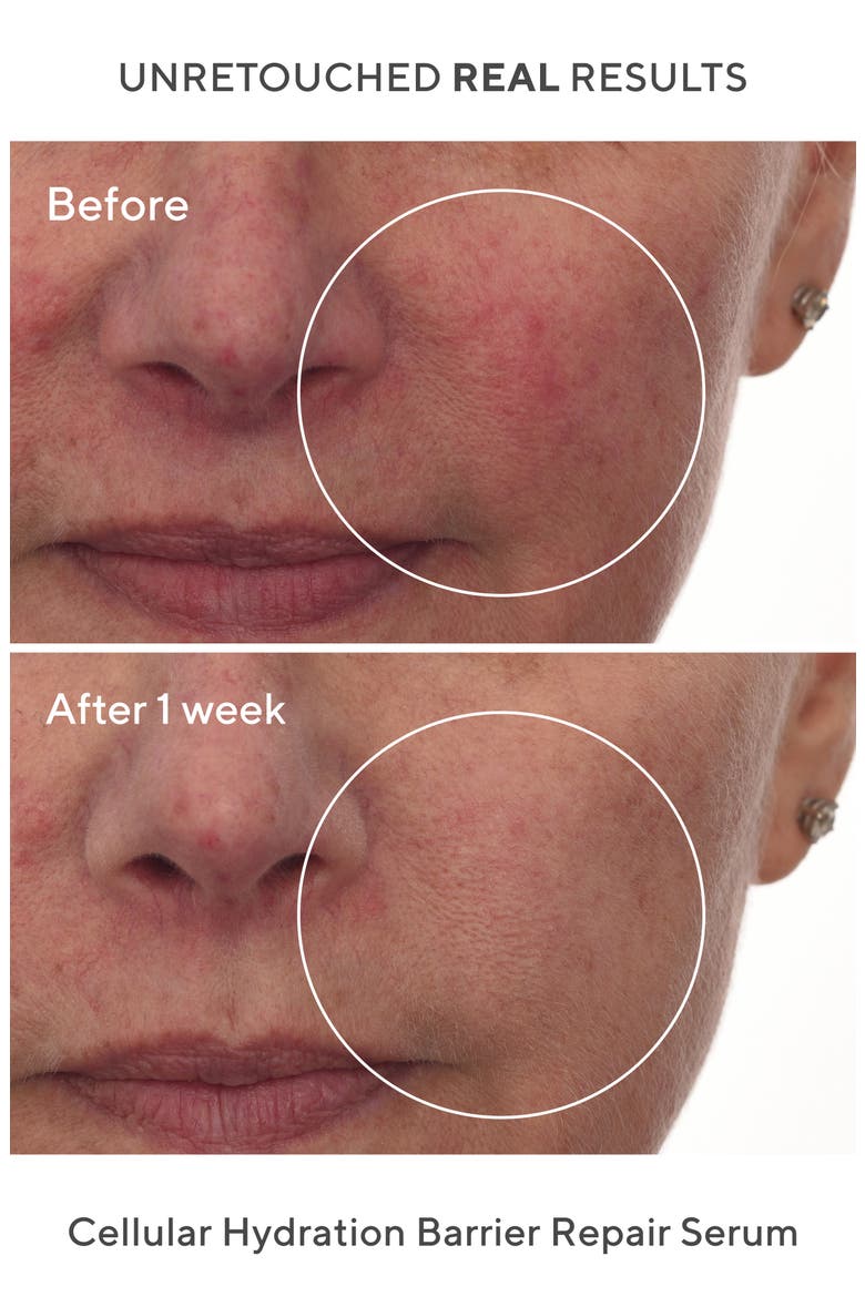 Hydration Barrier Repair Serum, Alternate, color, NONE