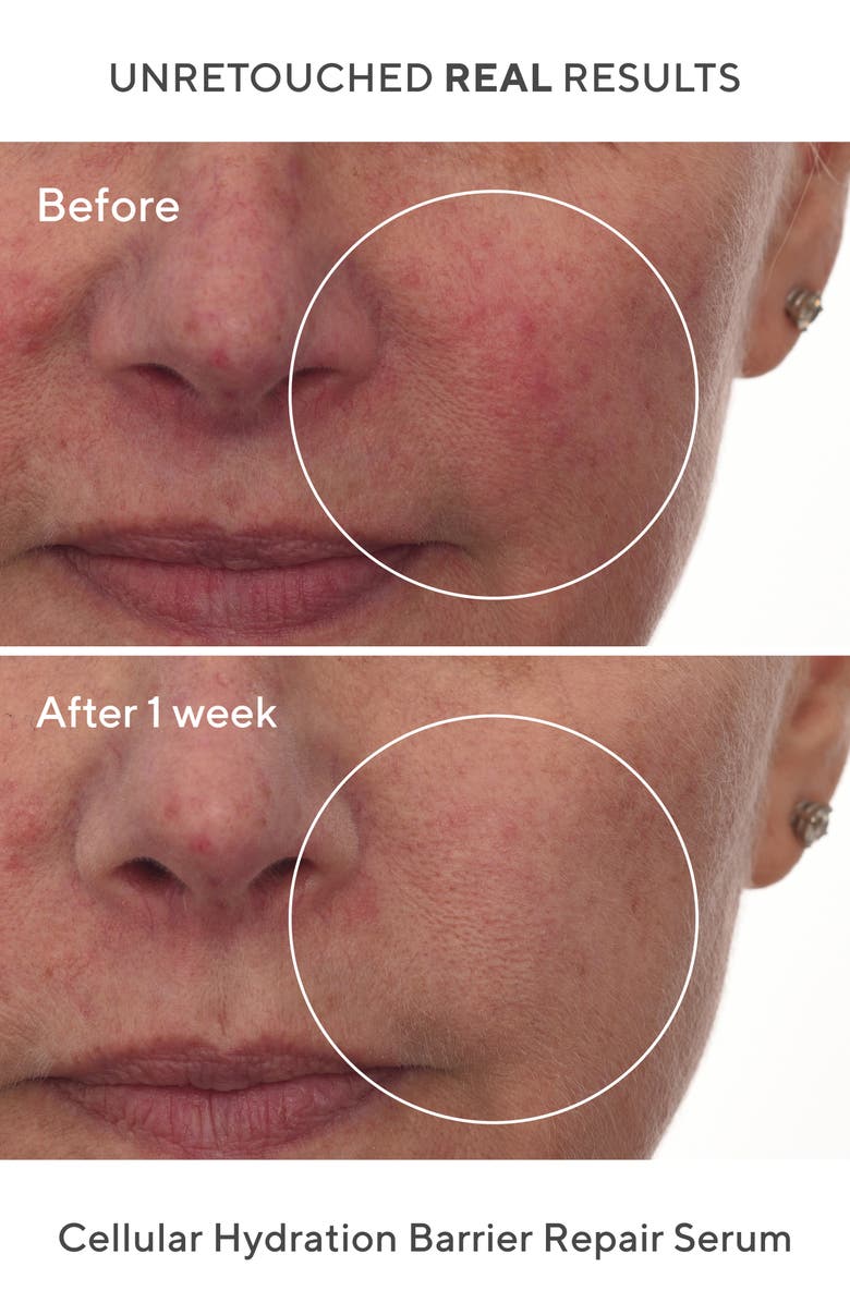 Murad<sup>®</sup> Hydration Barrier Repair Serum, Alternate, color,