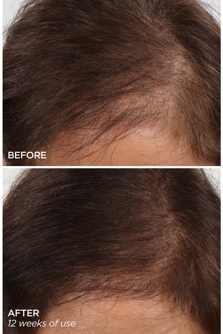 GloPRO® Rejuvenating Scalp + Fuller Hair Therapy Set, Alternate, color, NO COLOR