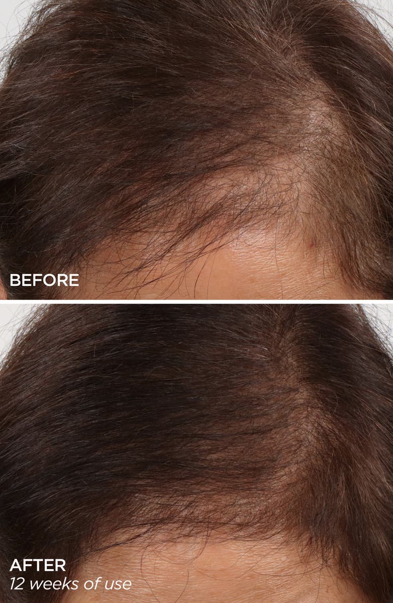 BeautyBio GloPRO<sup>®</sup> Rejuvenating Scalp + Fuller Hair Therapy Set, Alternate, color,