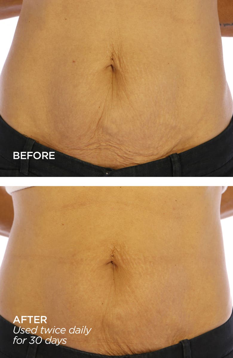 BeautyBio GloPRO<sup>®</sup> BODY MicroTip<sup>™</sup> Attachment & Body Cream Set, Alternate, color, 