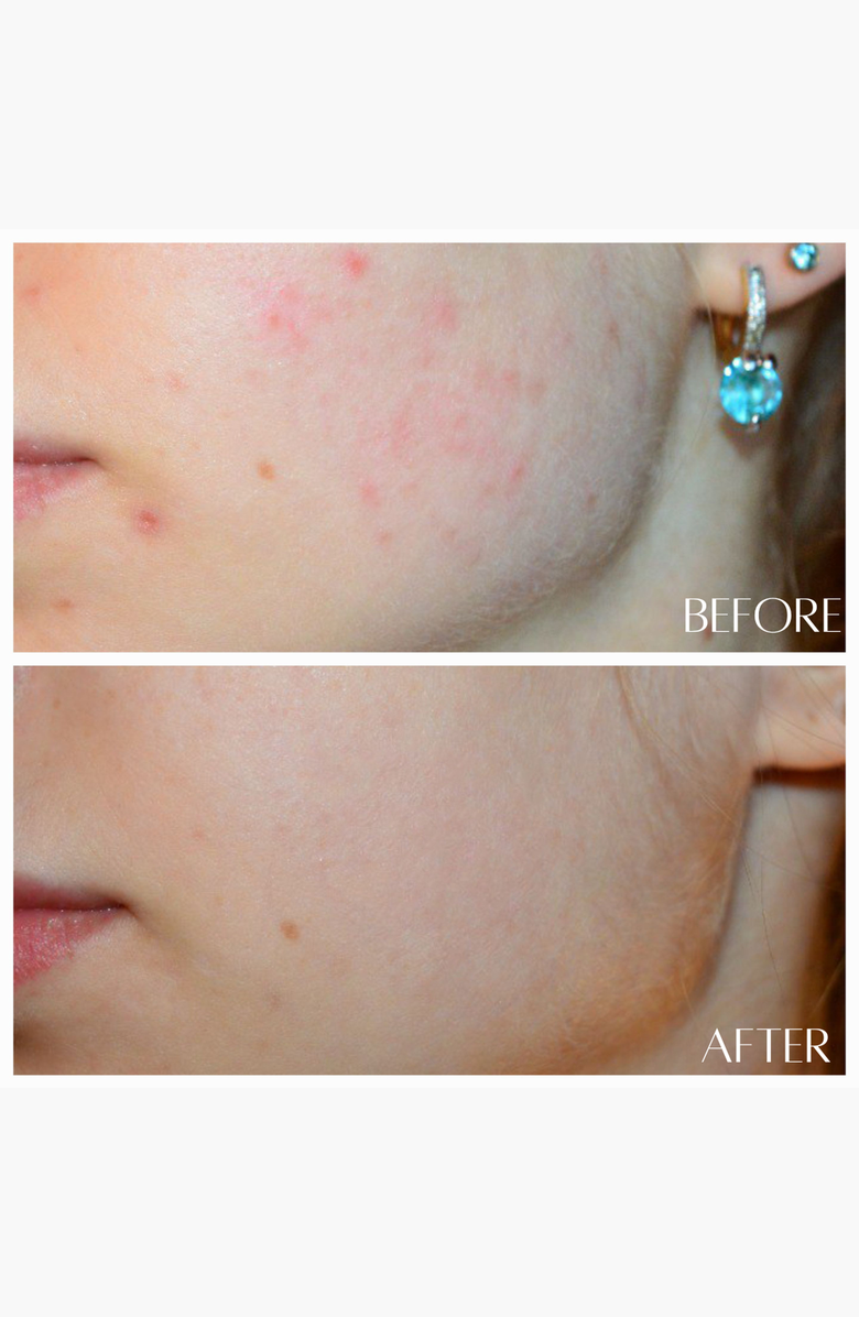 botanicary No. 5 RECOVER HydroFlora Balancing Mist, Alternate, color, Amber / Brown