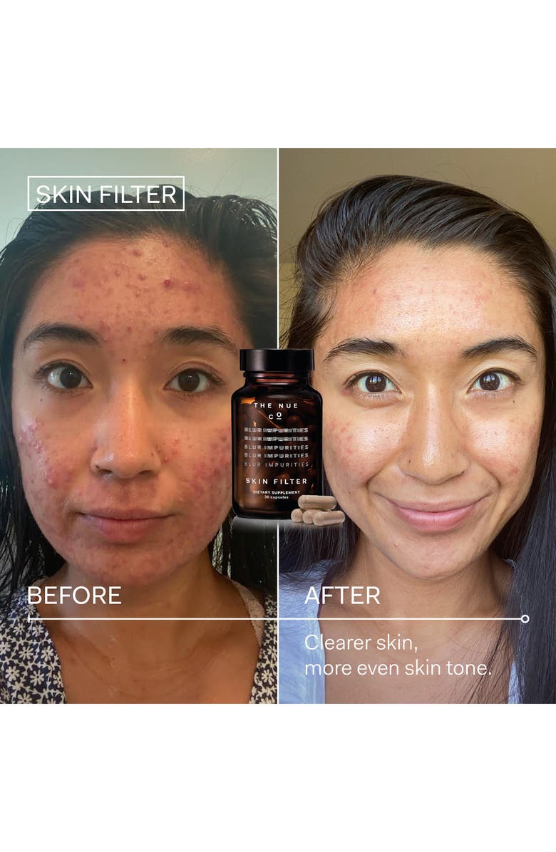 The Nue Co Skin Filter Dietary Supplement, Alternate, color, 