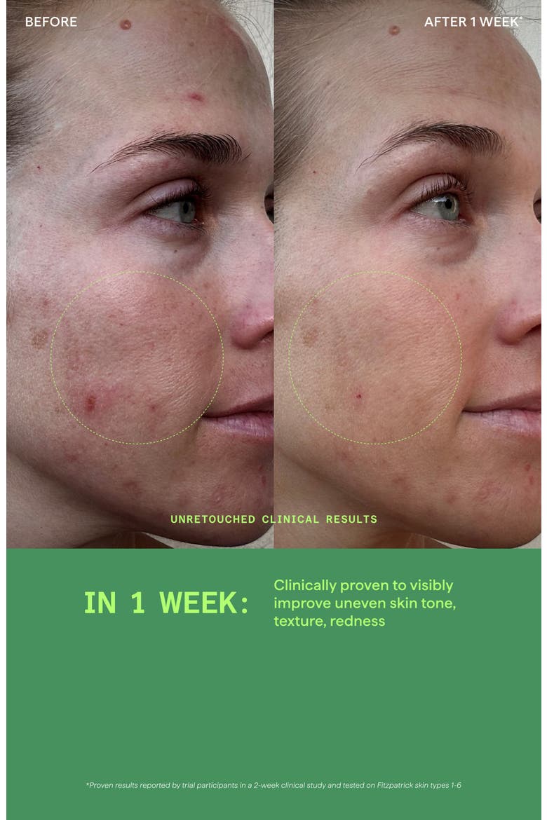 Biome-Balancing Calm & Recover Cream, Alternate, color, NO COLOR